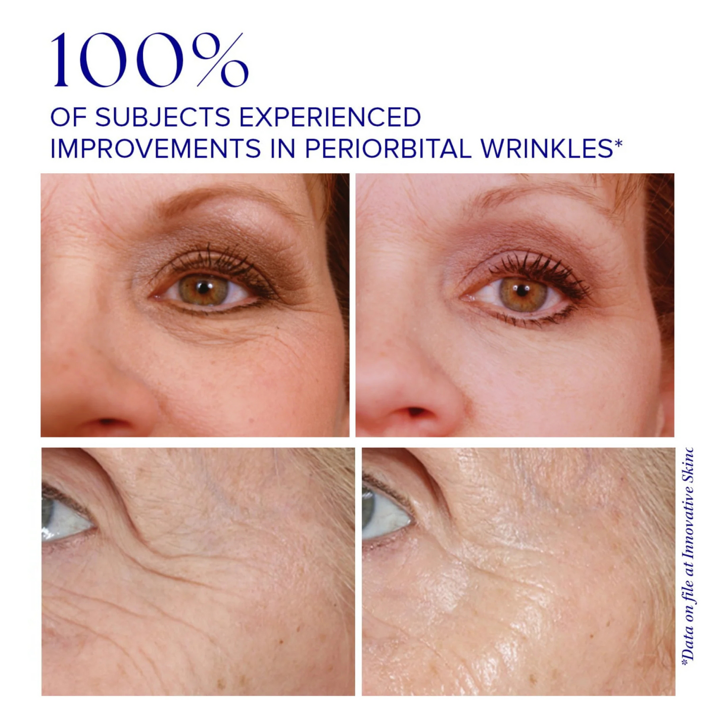 iS Clinical Youth Eye Complex