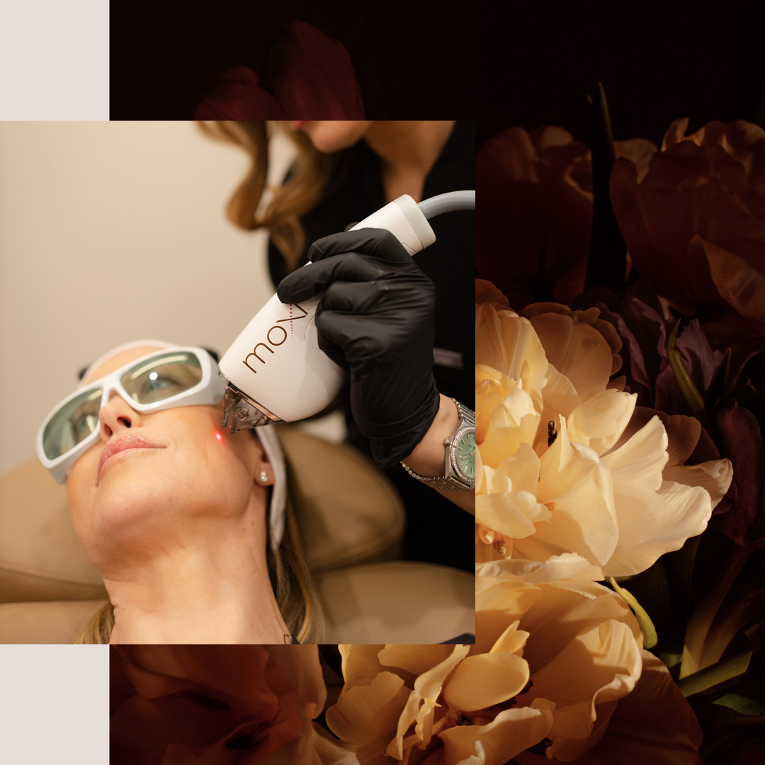 sciton laser treatments