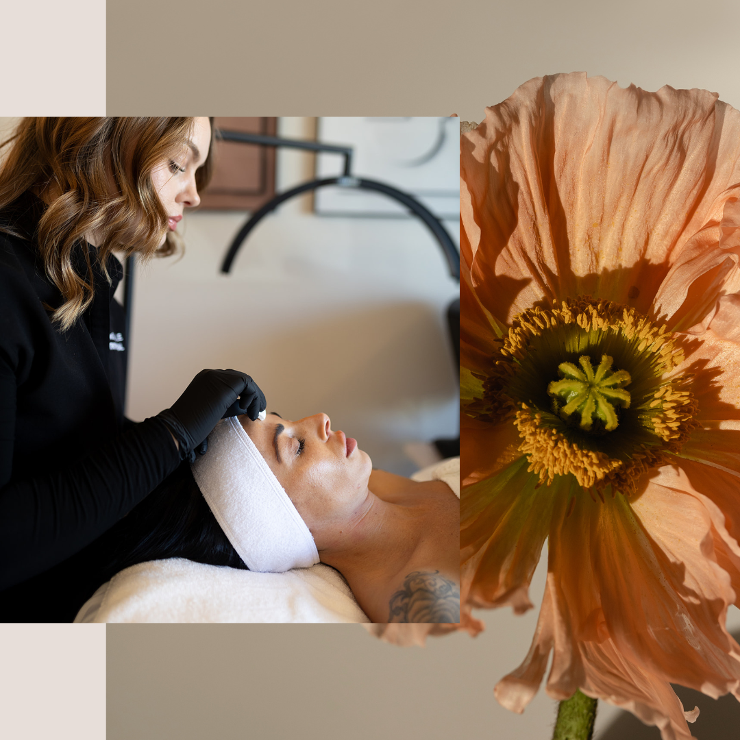 GUILFORD MED SPA services, Best Treatments for Enlarged Pores