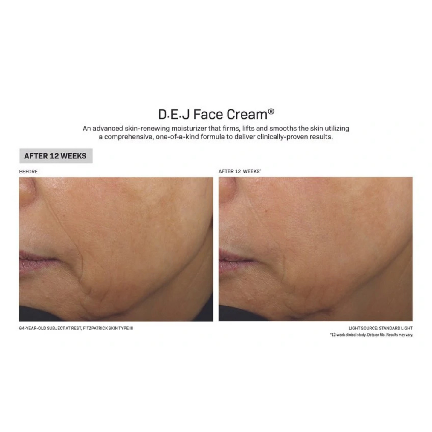 D·E·J Face Cream®