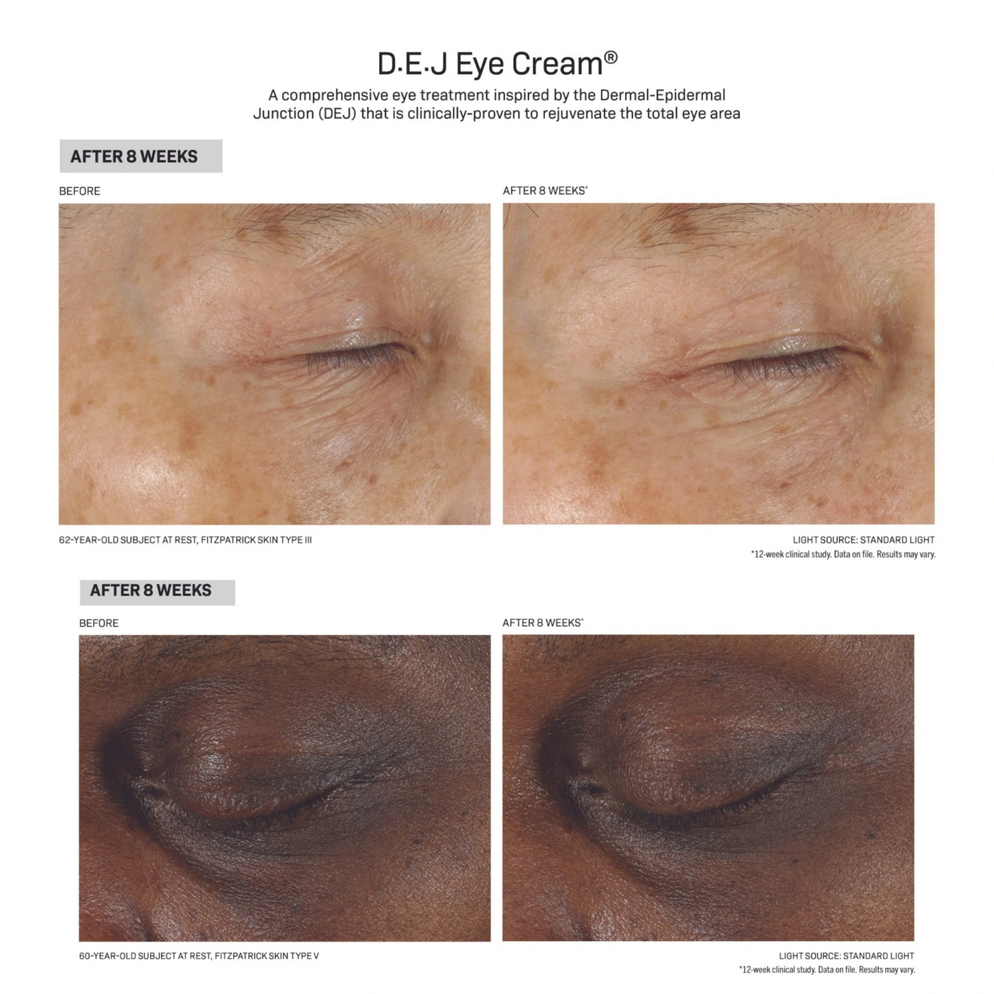 D·E·J Eye Cream®