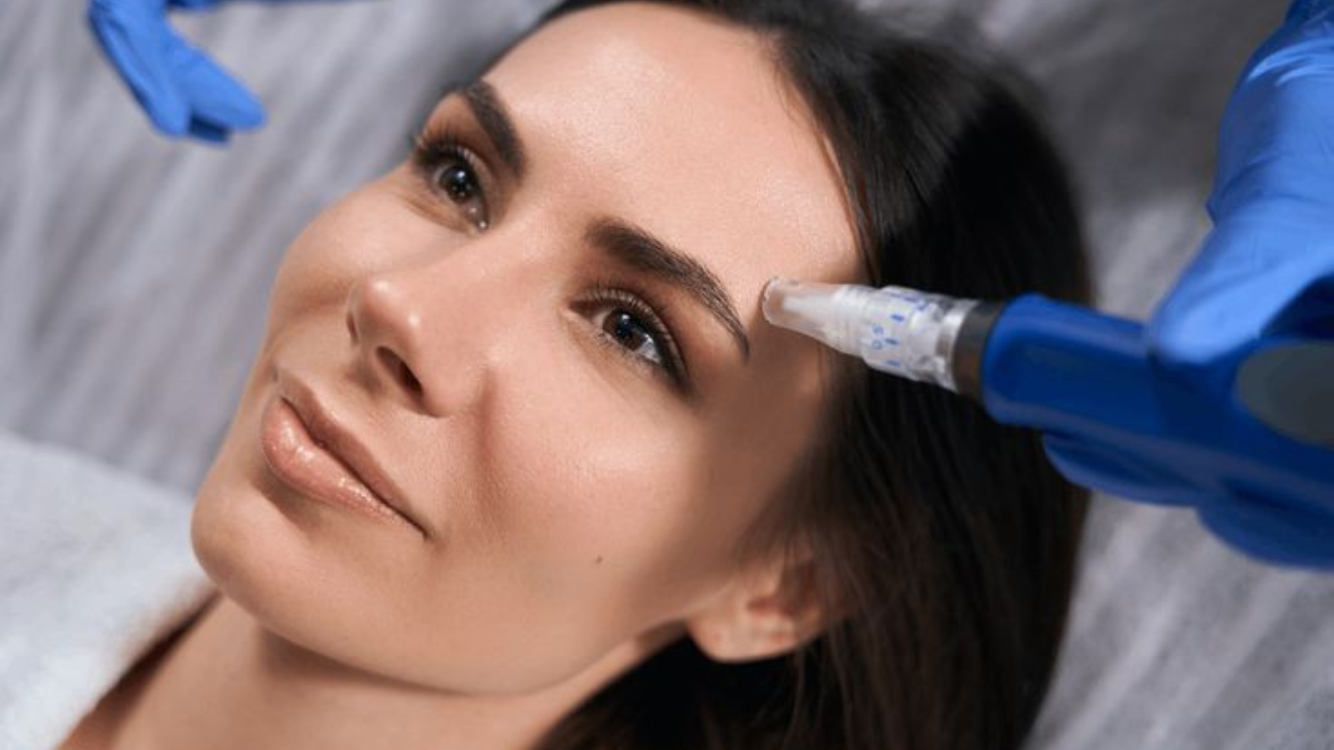guilford ct microneedling treatment