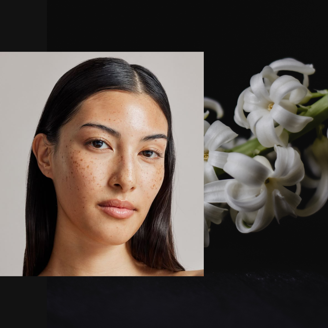 fine lines & wrinkles treatment