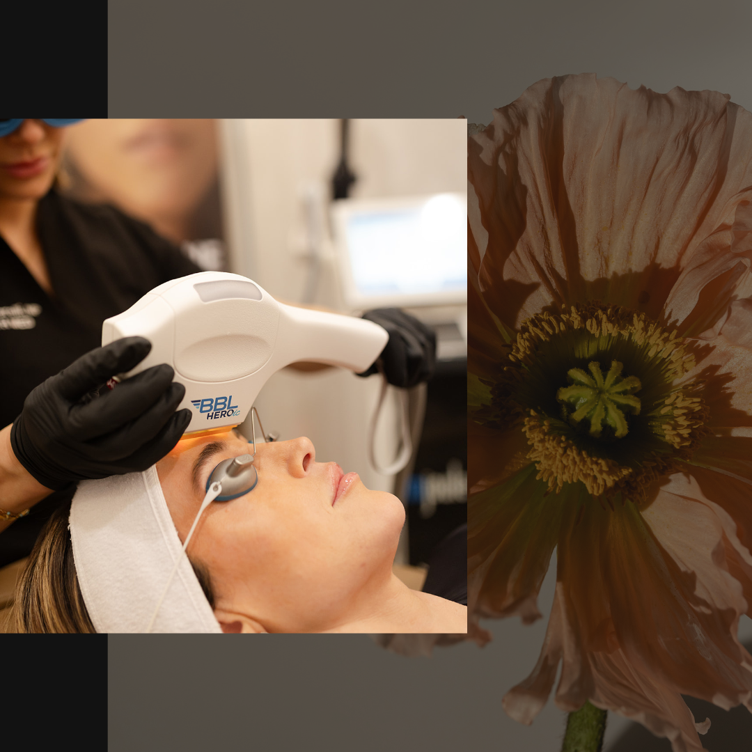 acne & acne scar treatment