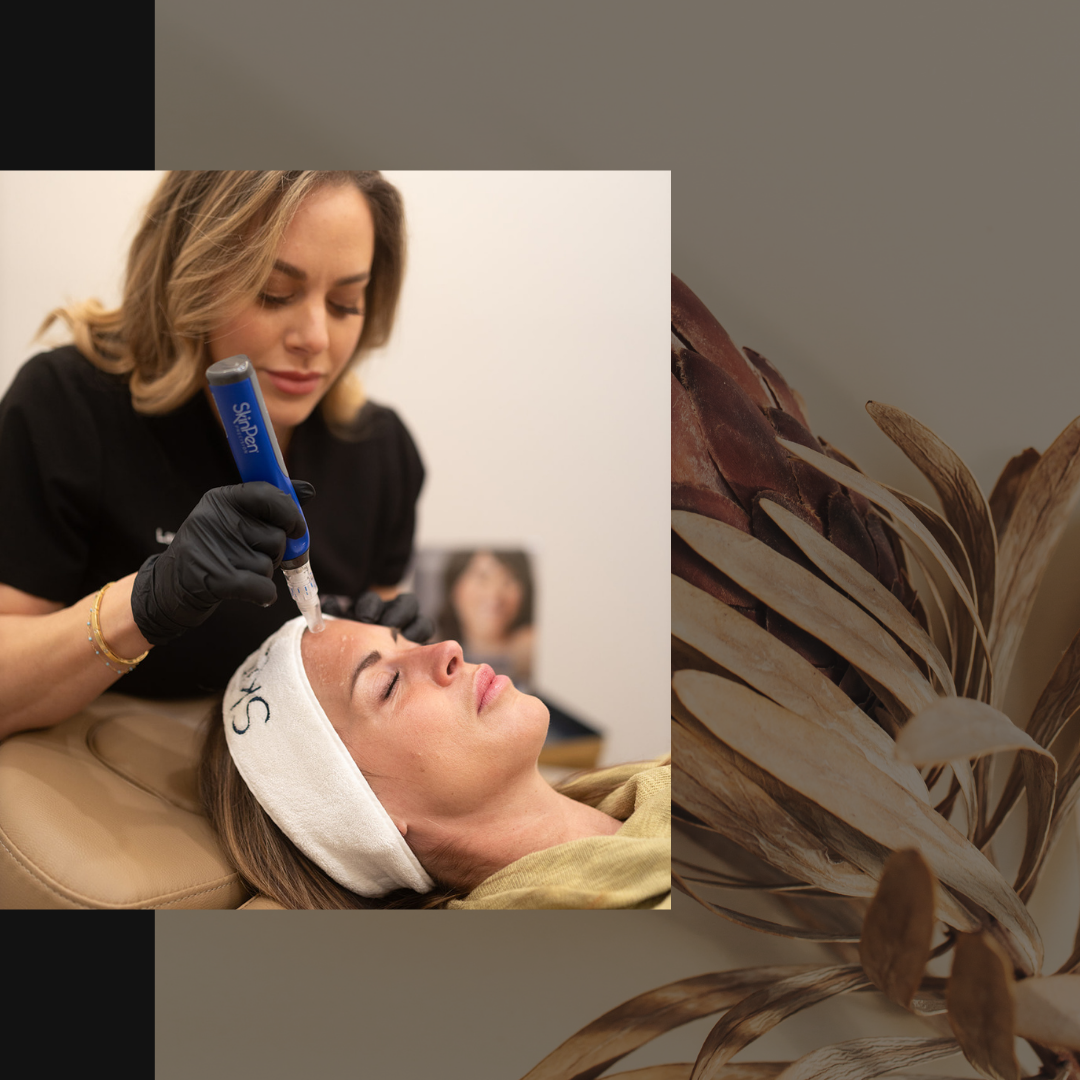 guilford ct microneedling treatment, treatments for skin laxity, Non-surgical stretch mark treatments