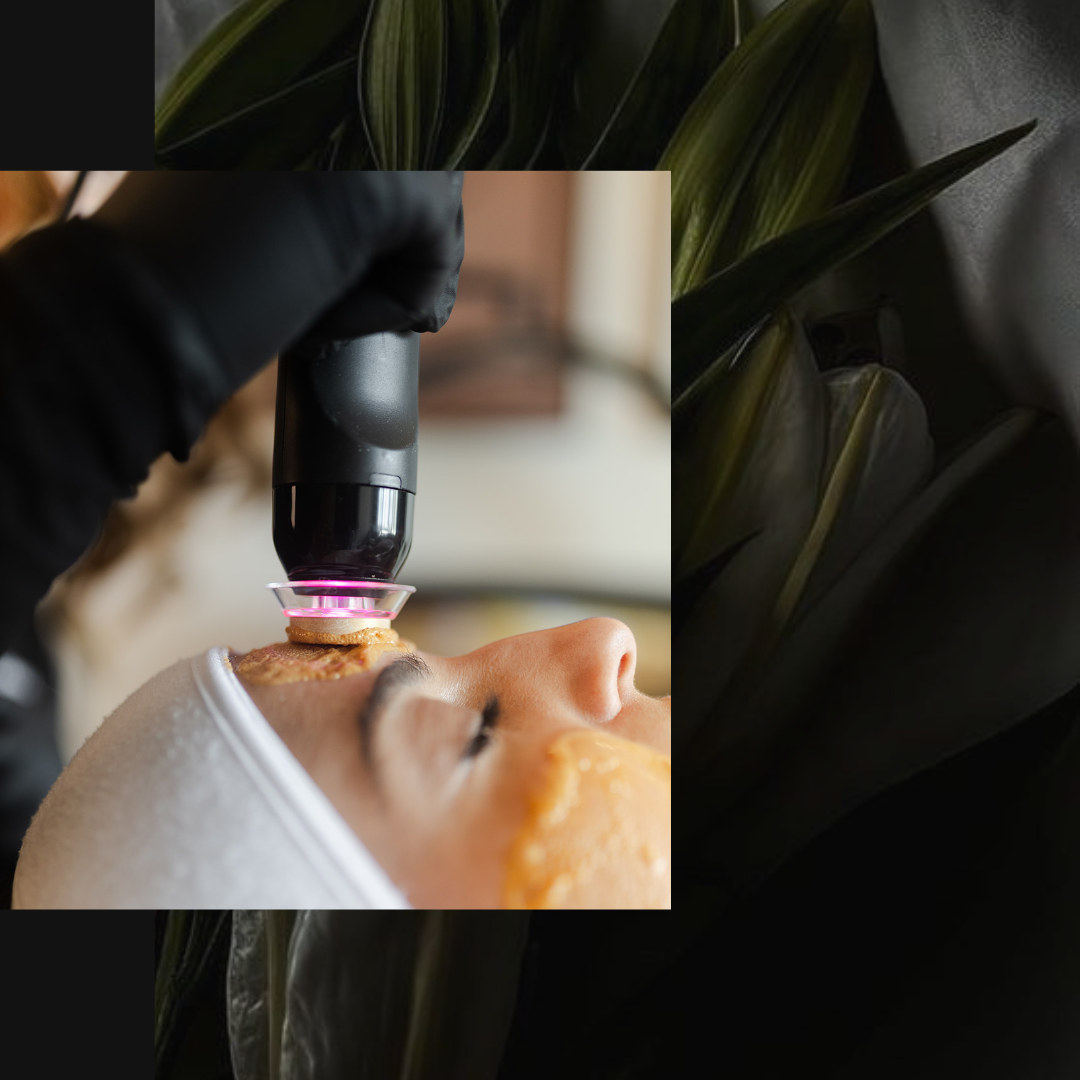 medical-grade facial treatments guilford