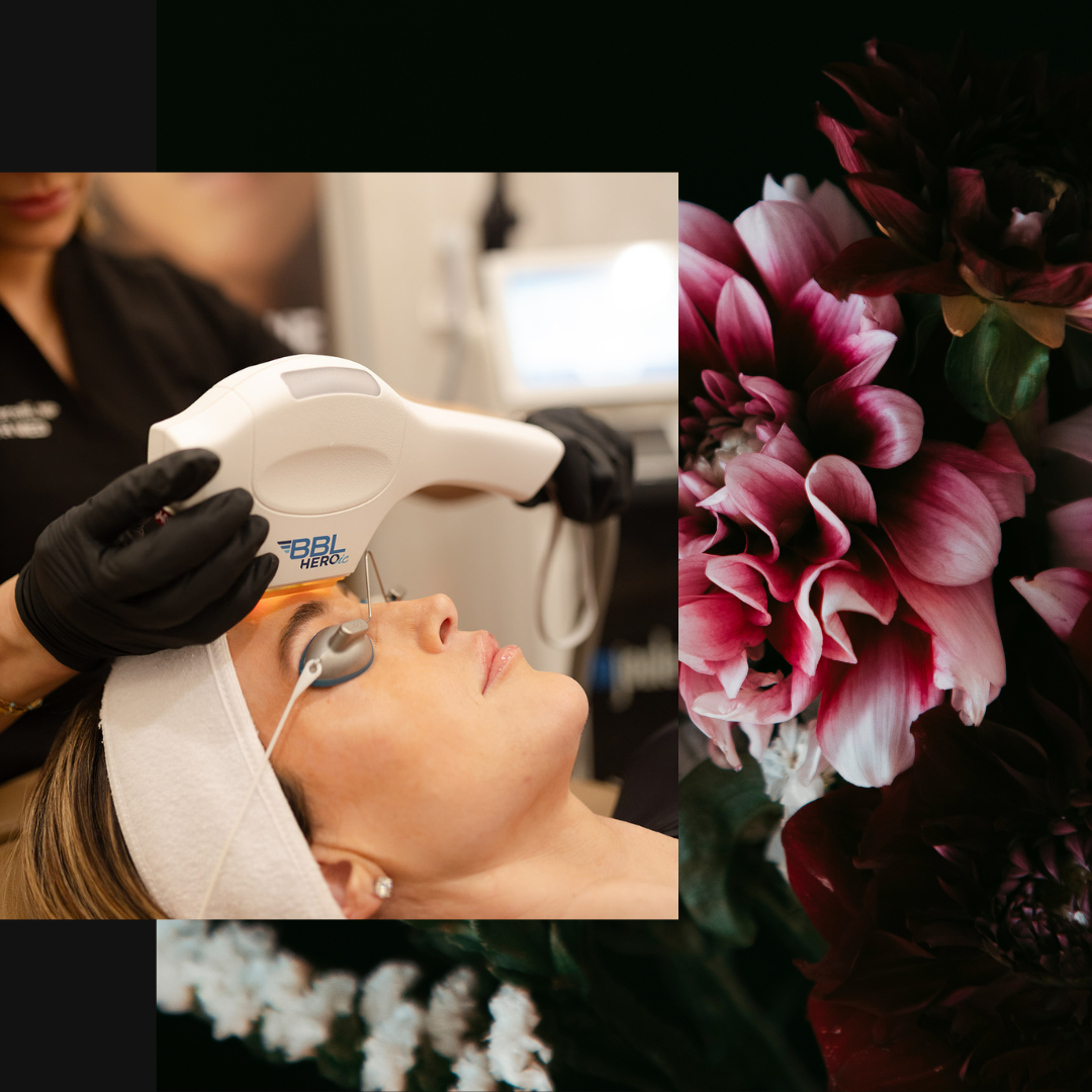 sciton laser treatments