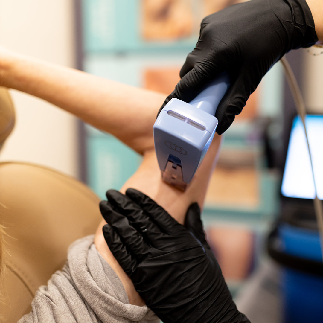 Non-surgical Skin Tightening Treatment, treatments for skin laxity