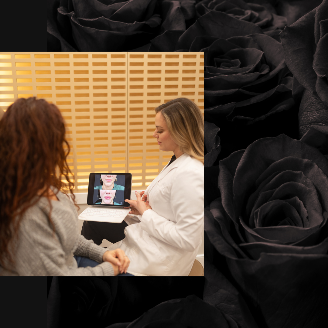 Dermal Fillers Connecticut Med Spa, fine lines & wrinkles treatment