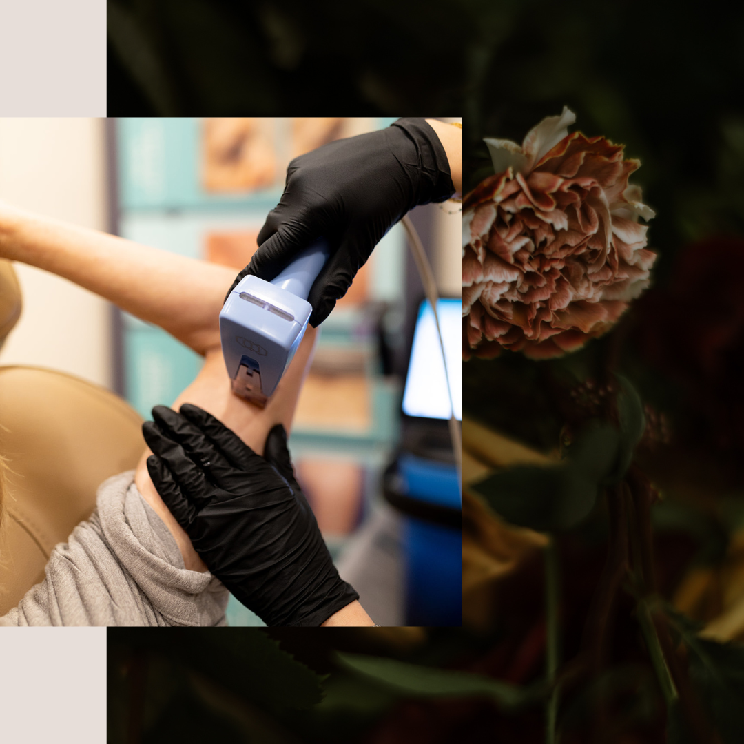 Non-surgical Skin Tightening Treatment