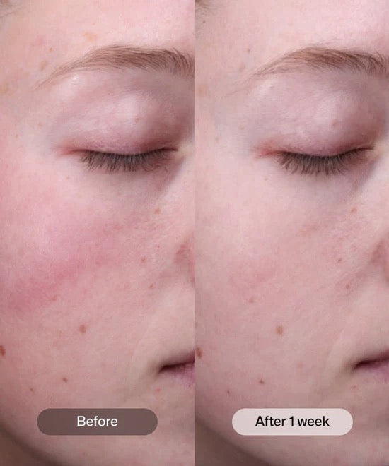 Radiance+ Resurfacing Serum