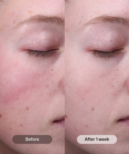 Radiance+ Resurfacing Serum