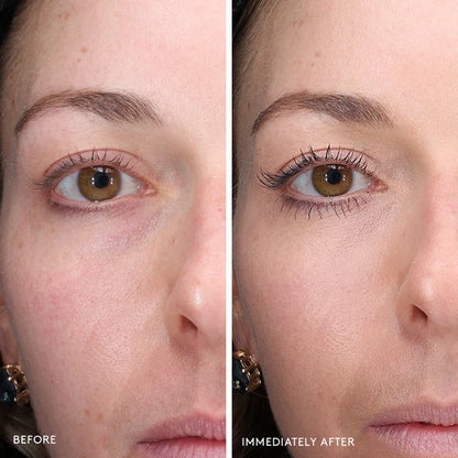 Total Eye® 3-in-1 Renewal Therapy SPF 35