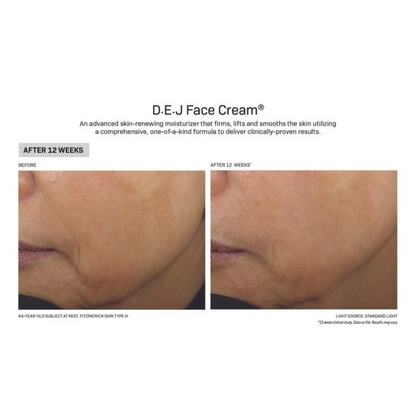 D·E·J Face Cream®
