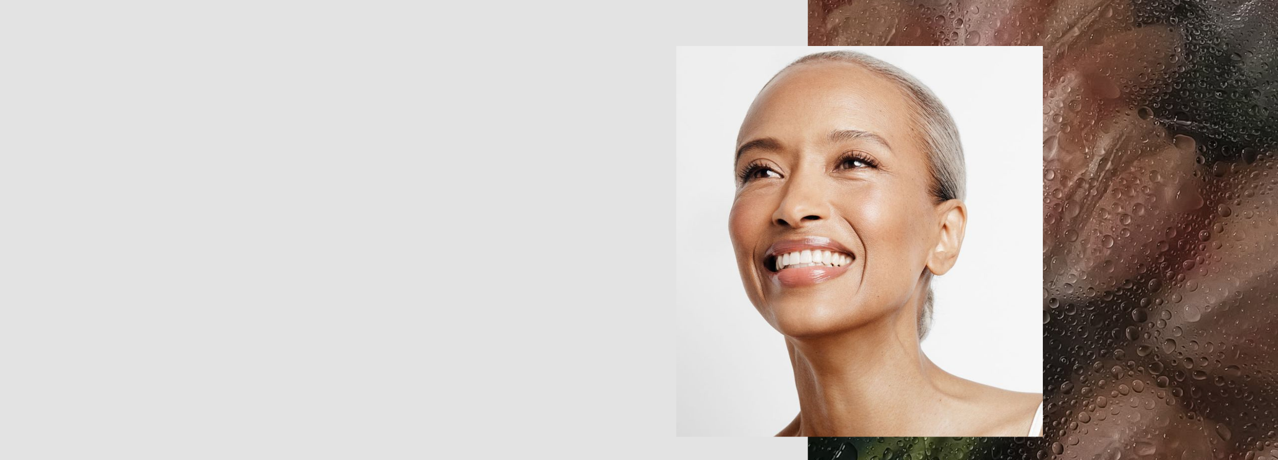 sciton skintyte treatment