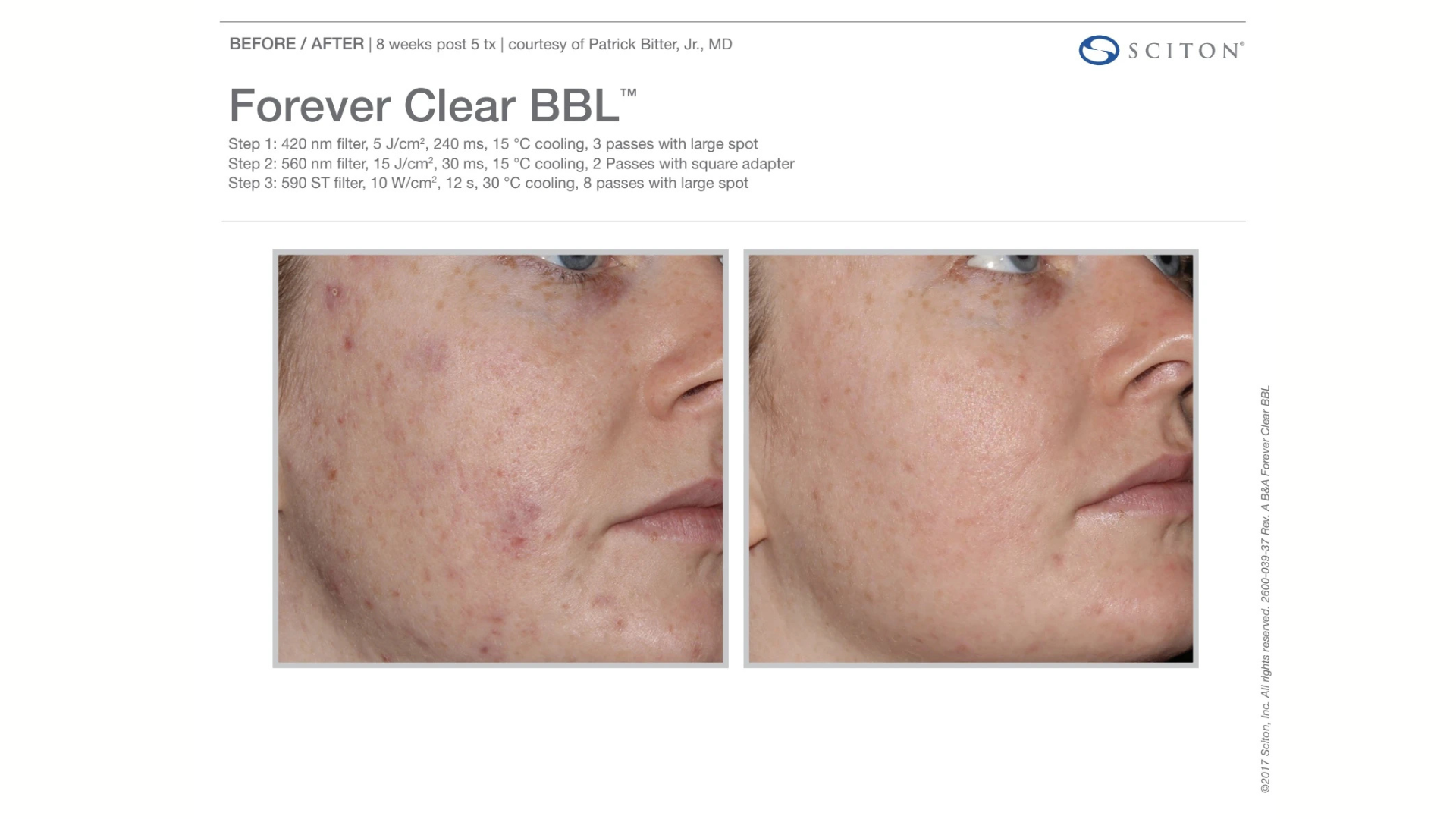 non-invasive Skin Rejuvenation Treatments