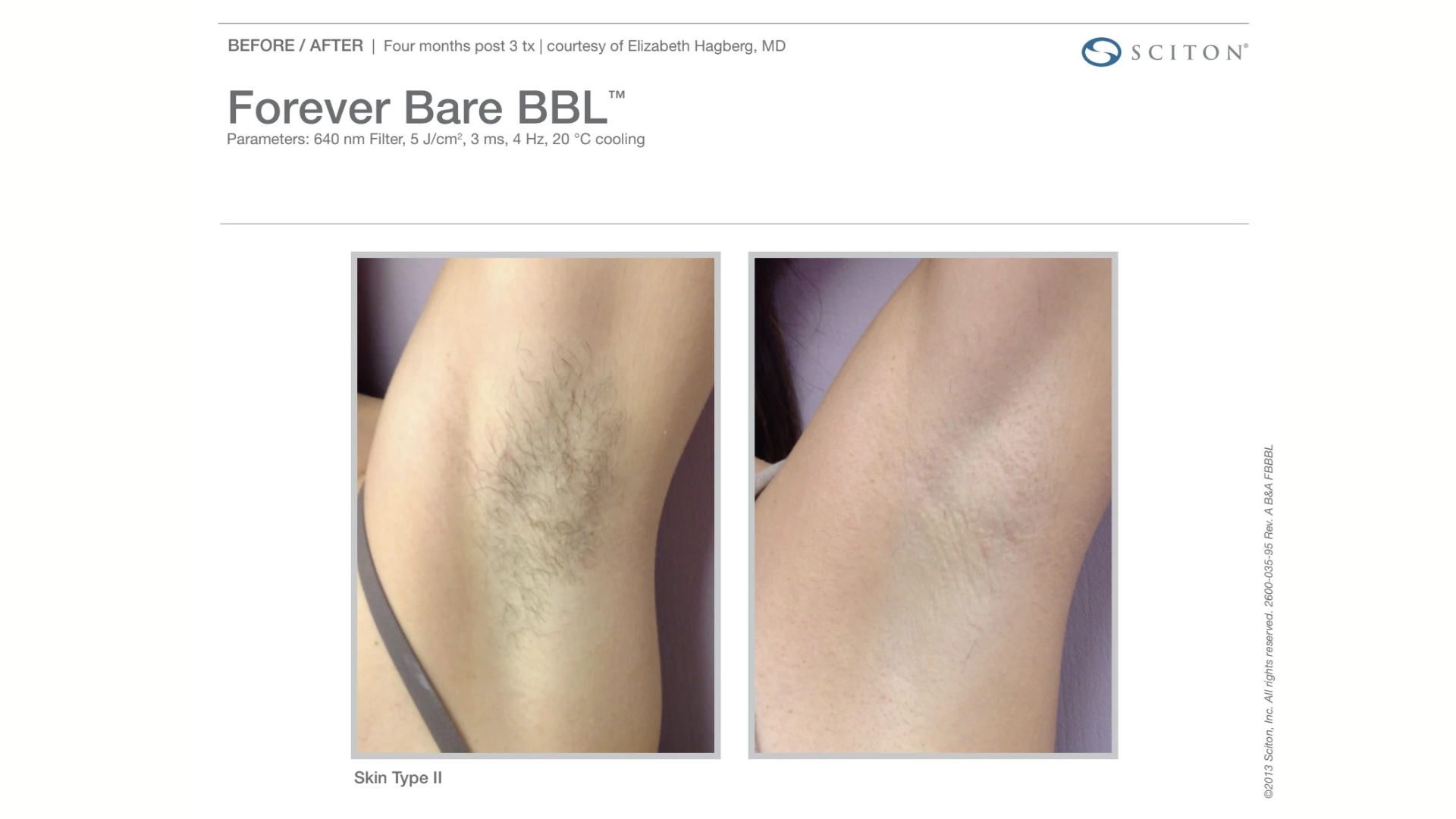 non-invasive Skin Rejuvenation Treatments