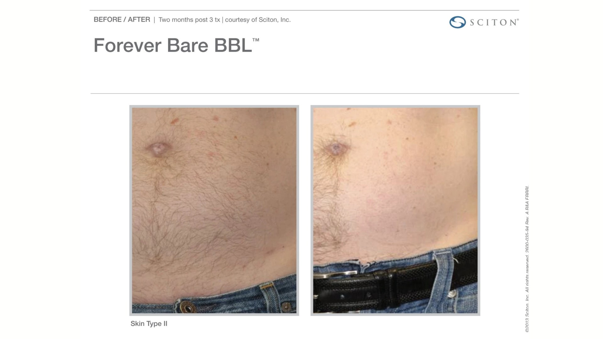 non-invasive Skin Rejuvenation Treatments