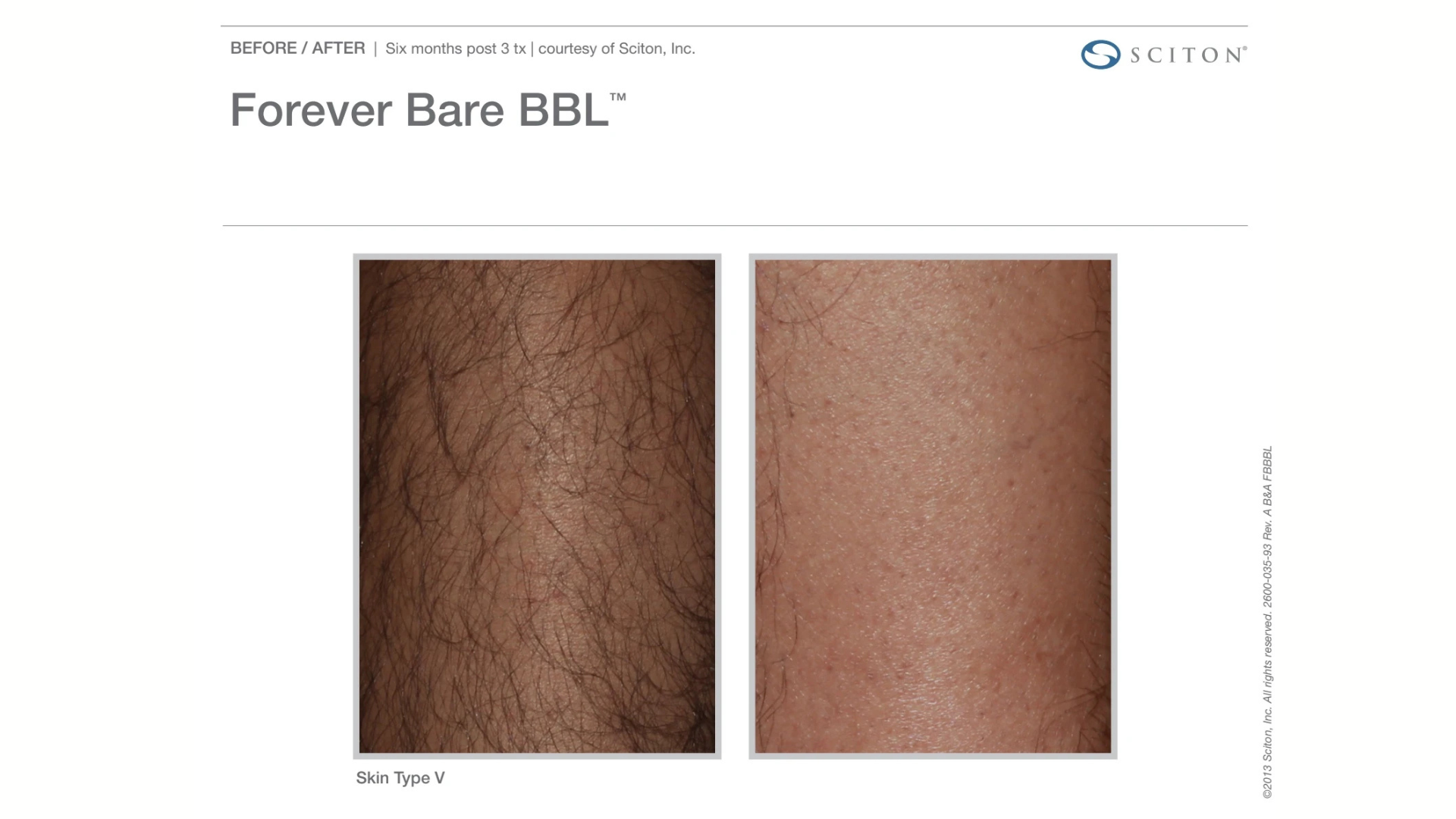 non-invasive Skin Rejuvenation Treatments